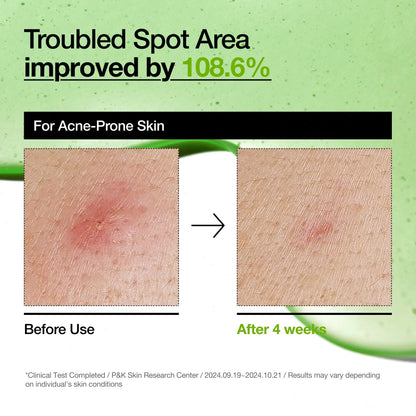 Azelaic Acid 10 Hyaluron Redness Soothing Serum